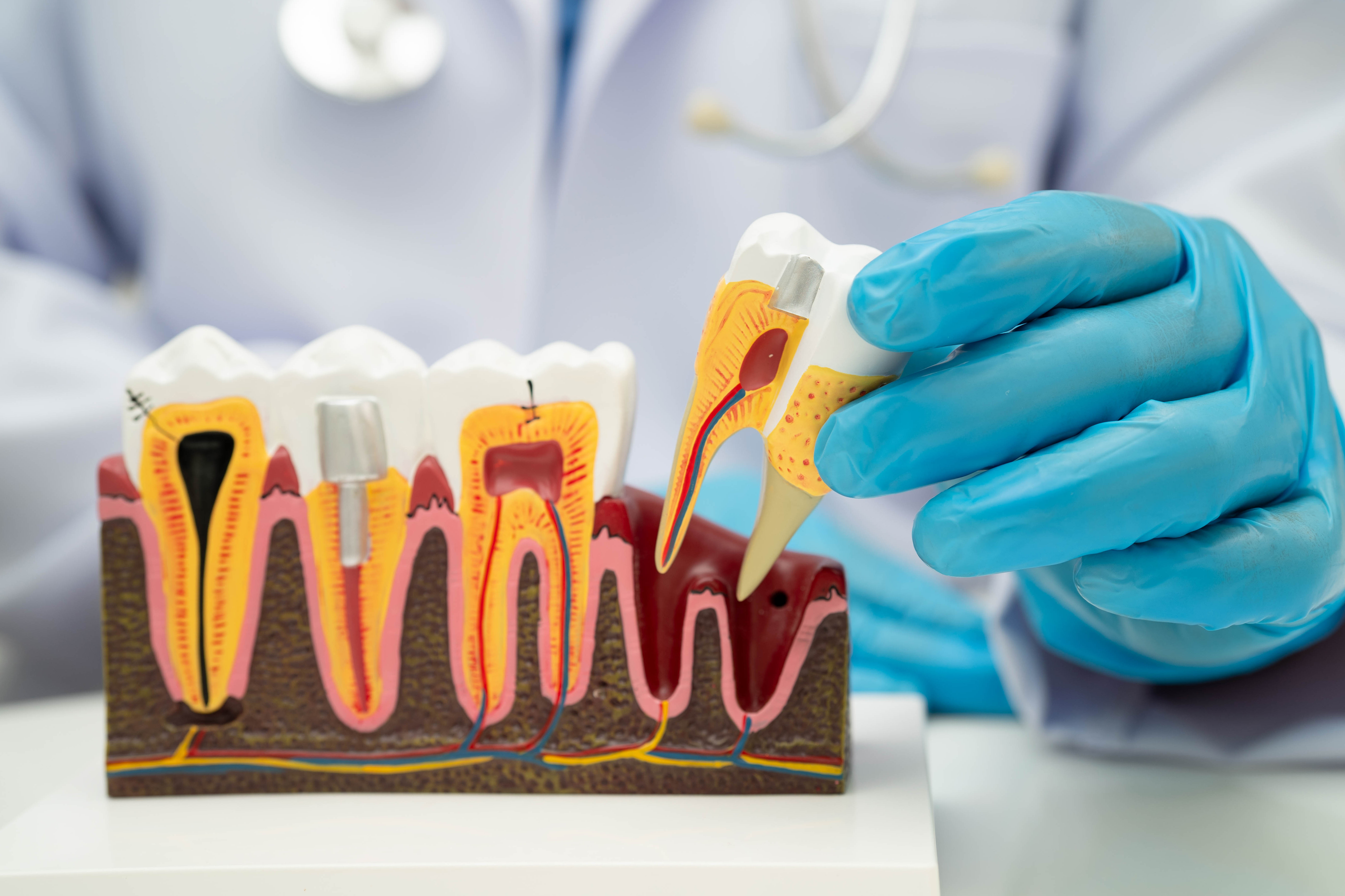 Имплантаты Nobel 