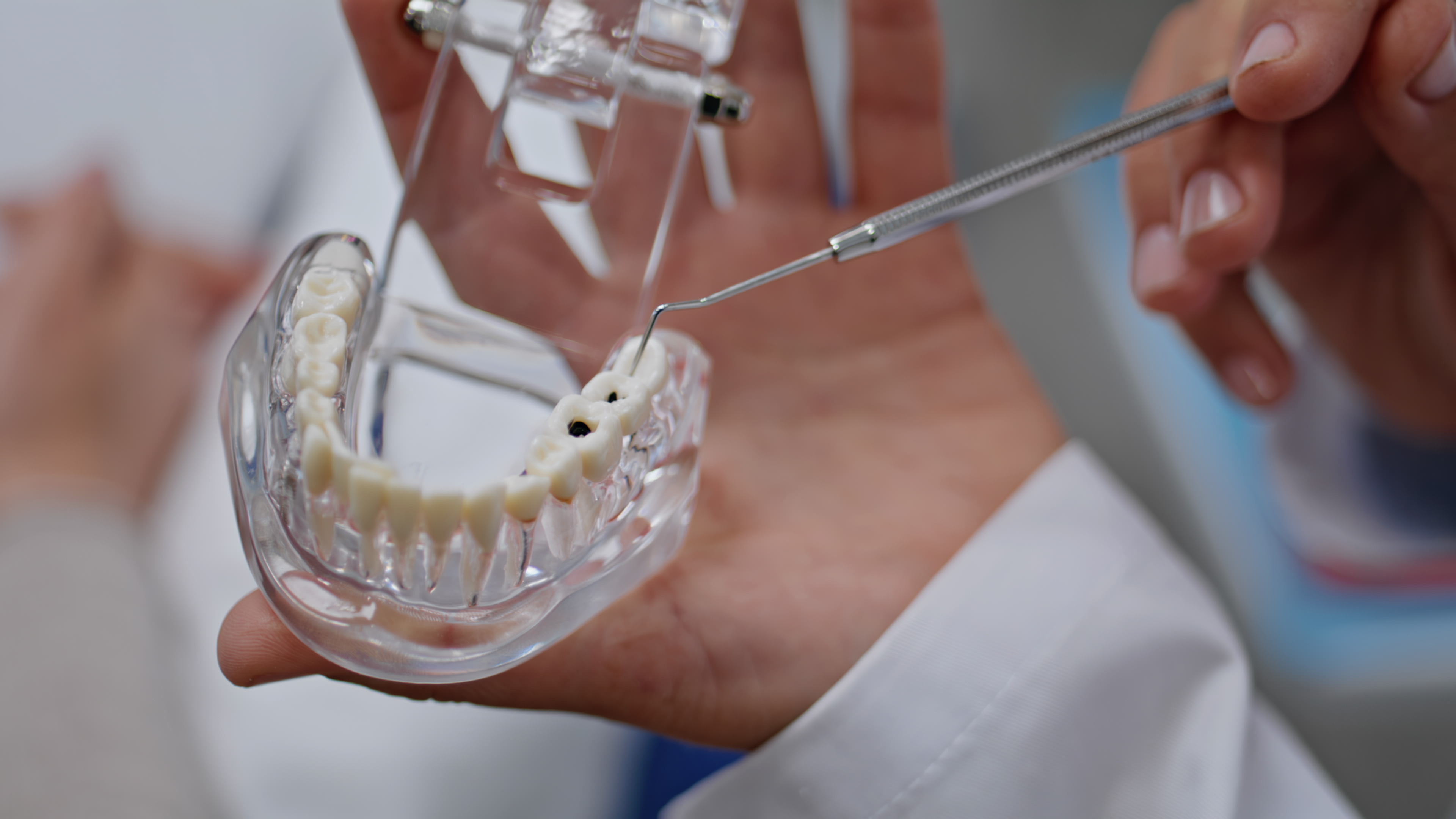 Протезирование All On 4 