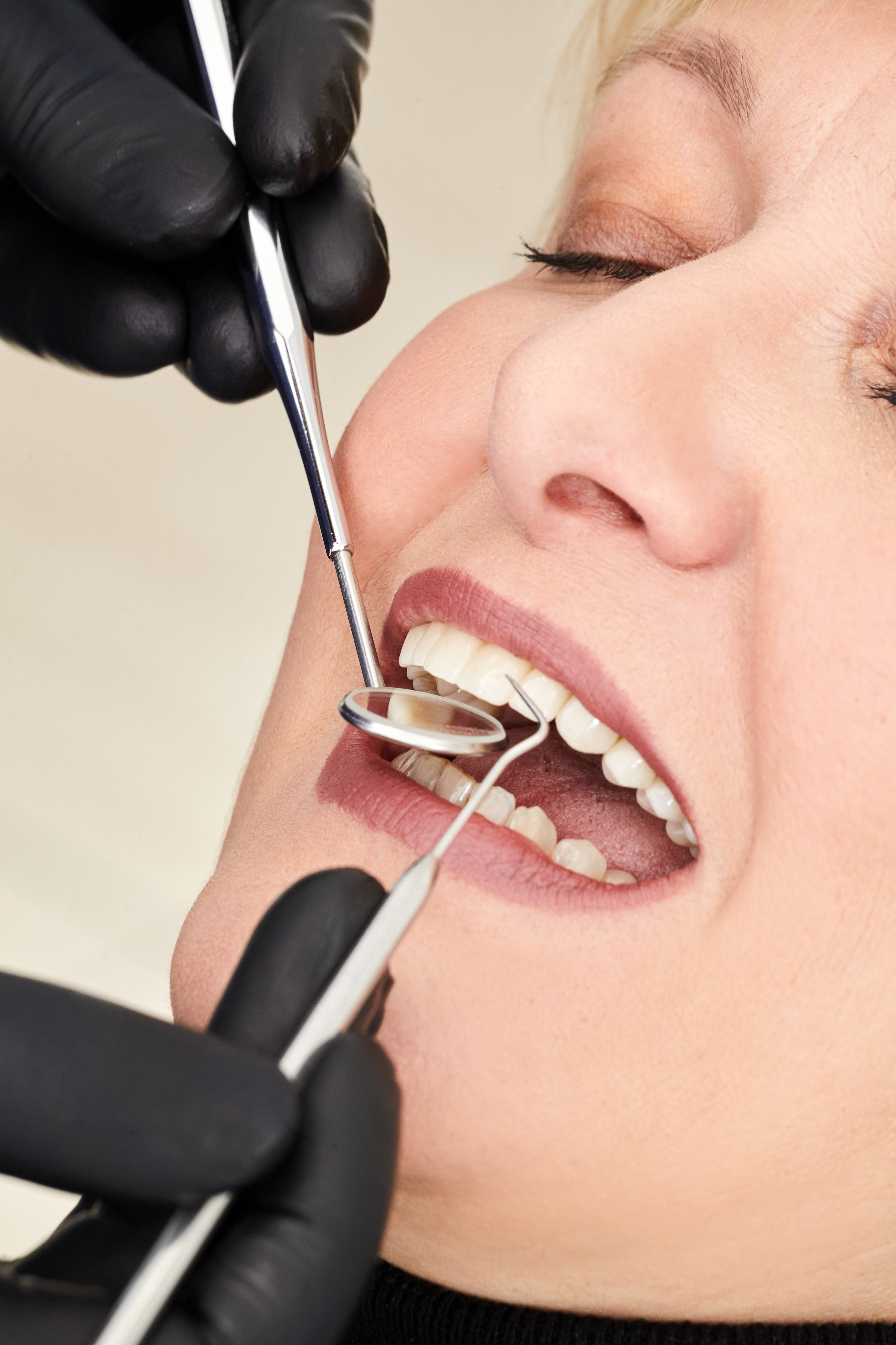 Гигиена полости рта 